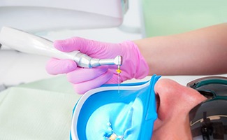Patient undergoing a root canal