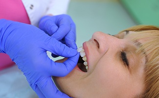 a closeup of veneers against a blue background